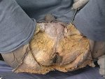 a male cadaver's anus.jpg