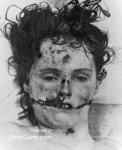 black-dahlia-elizabeth-short-autopsy-01.jpg