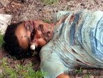 eyeball-dangle-out-skull-machete-blow-face-brazil-02.jpg