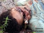 eyeball-dangle-out-skull-machete-blow-face-brazil-05.jpg