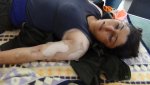 foto-chocante-jovem-curda-morta-por-armas-quc3admicas.jpg