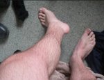 my feet.jpg