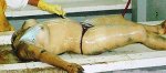 Headless_woman_in_the_morgue.jpg