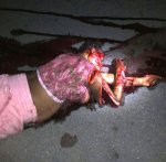 Crazy Haitian Hacks Girlfriend to Pieces   (5).jpg