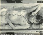 charonboat_dot_com_woman_after_autopsy_1.jpg